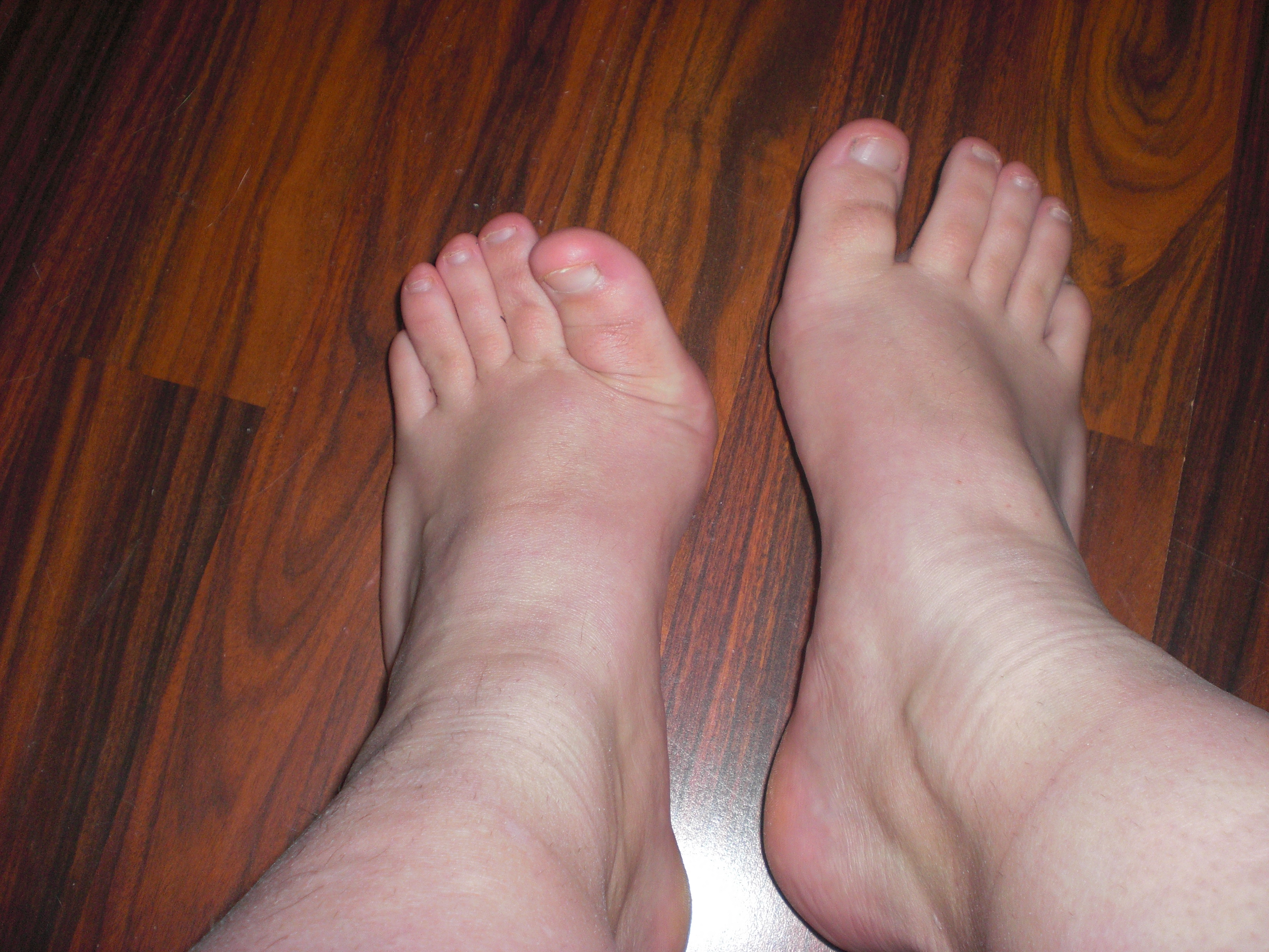 Feet